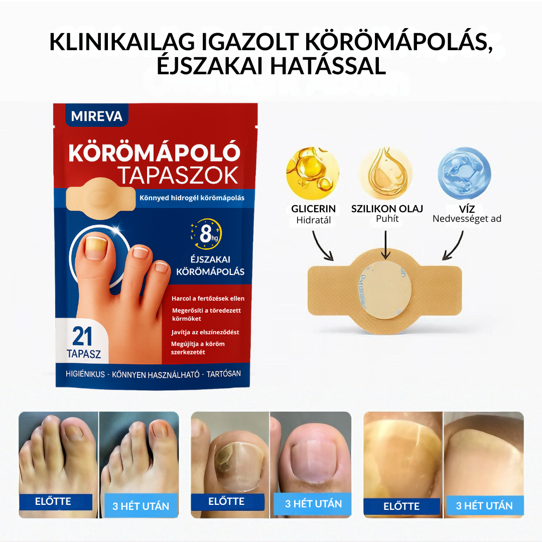 MIREVA - Körömápoló tapasz 21 db-os