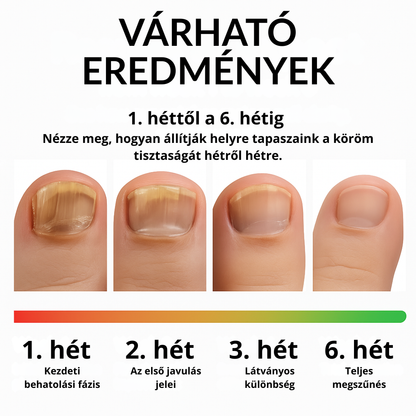 MIREVA - Körömápoló tapasz 21 db-os